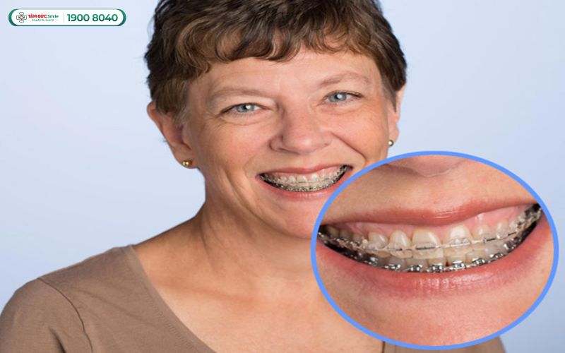 Việc điều trị ở tuổi 50 hoàn toàn khả thi nếu được chỉ định đúng