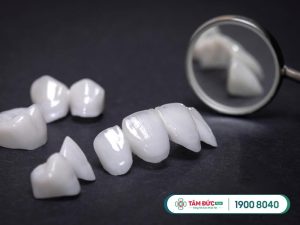 Răng toàn sứ sở hữu nhiều ưu điểm vượt trội