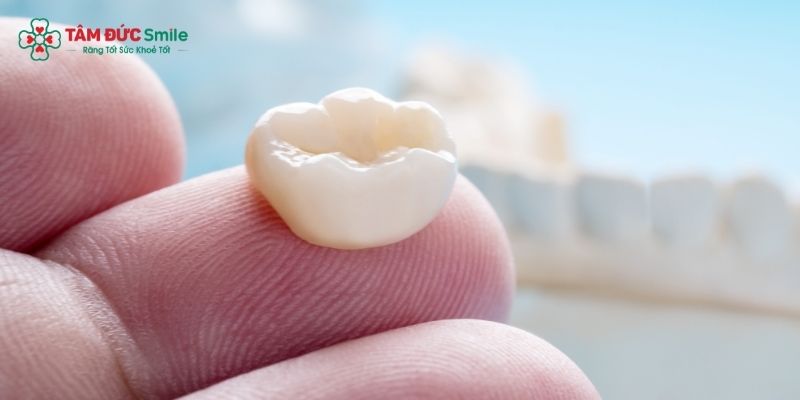 Bọc răng sứ 500k có tốt không?