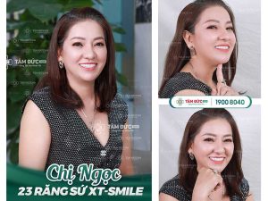 Bọc răng sứ trả góp đang được nhiều cô chú, anh chị lựa chọn bởi đây là giải pháp tối ưu tài chính cho nhu cầu làm đẹp nụ cười