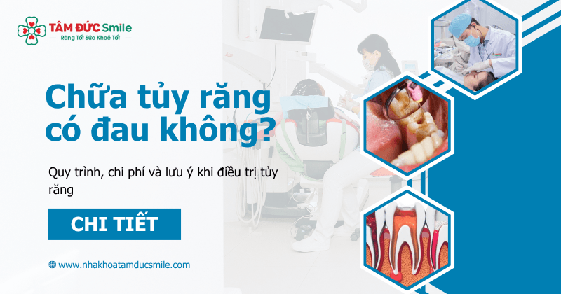 Điều trị tủy răng (hay còn gọi là chữa tủy) là một thủ thuật nha khoa nhằm loại bỏ phần tủy bị viêm hoặc hoại tử