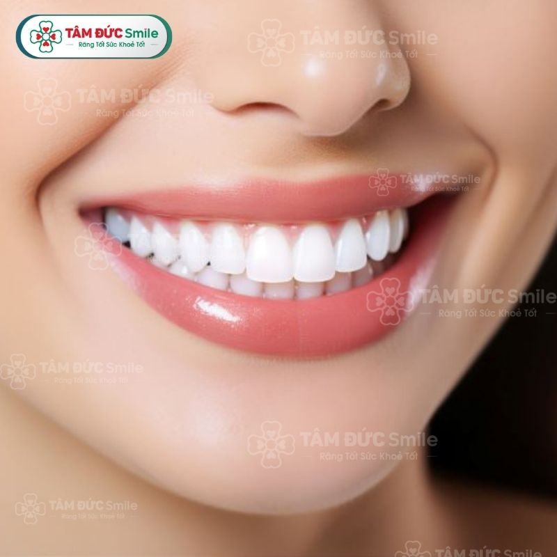 Cười quá nhiều có thể gây thiếu oxy hoặc là biểu hiện của bệnh lý