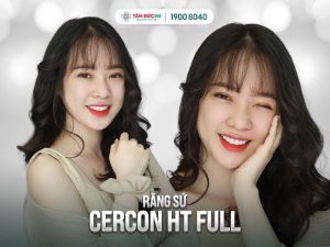 Răng sứ là lựa chọn hoàn mỹ khi Quý khách muốn sở hữu nụ cười "vạn người mê"