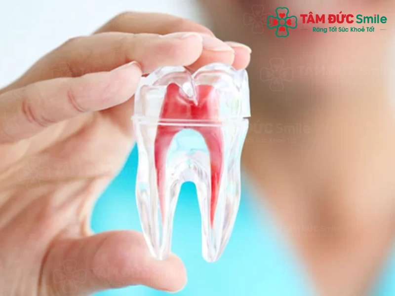 Điều trị tủy răng lần 2 không gây đau đớn