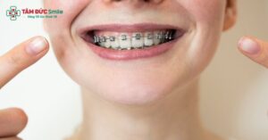 Người bị lệch mặt có thể niềng răng để cải thiện