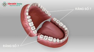 Vị trí răng số 7