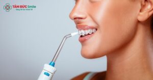 Sử dụng máy tăm nước khi niềng răng giúp làm sạch răng miệng hiệu quả hơn
