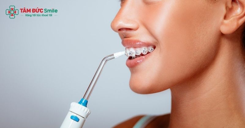 Sử dụng máy tăm nước khi niềng răng giúp làm sạch răng miệng hiệu quả hơn