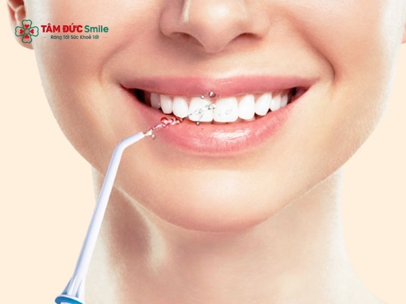 Sử dụng máy tăm nước là phương pháp hiệu quả để duy trì sức khỏe răng miệng
