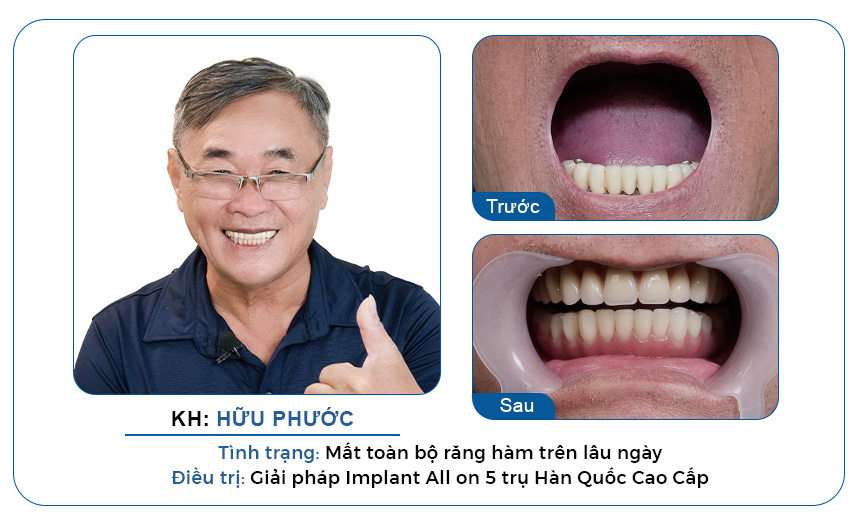 ca điều trị thực tế của bác sĩ Ngô Minh Trí 1