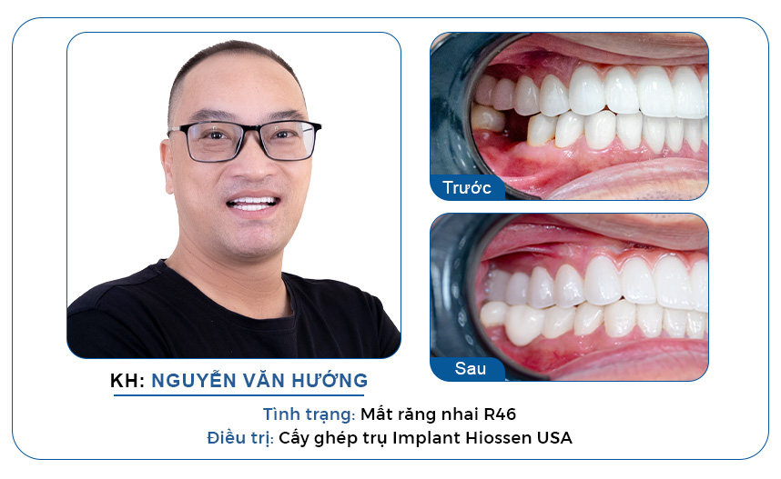 ca điều trị thực tế của bác sĩ Ngô Minh Trí3