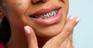 Điều trị răng cắn ngược giúp cải thiện thẩm mỹ nụ cười, tăng sự tự tin khi giao tiếp