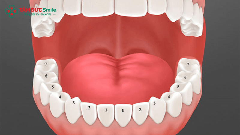 Một số phác đồ niềng răng cần nhổ răng số 4 hoặc 5 để tạo khoảng di chuyển răng