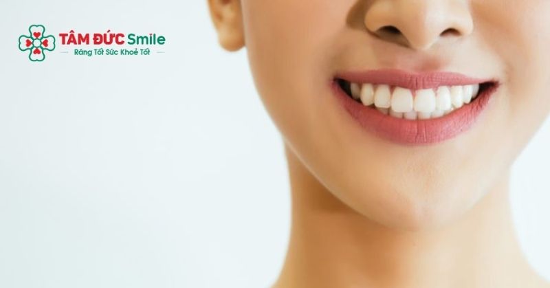Răng hô nhẹ vẫn đẹp nếu không ảnh hưởng khớp cắn, ăn nhai, phát âm và khả năng khép môi.