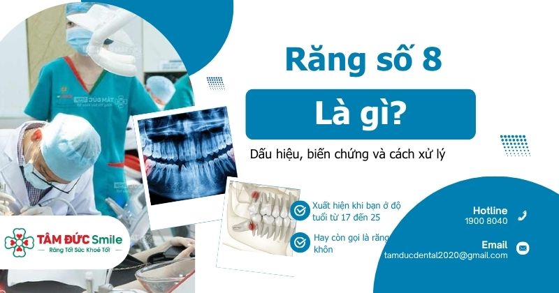 Răng số 8 hay còn gọi là răng khôn, nằm ở vị trí răng hàm lớn thứ ba và thường mọc trong giai đoạn 17–25 tuổi