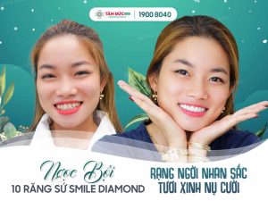 Được mệnh danh là “Nữ hoàng răng sứ” - Smile Diamond đem lại sự may mắn, giàu sang mang lại vẻ đẹp không tì vết