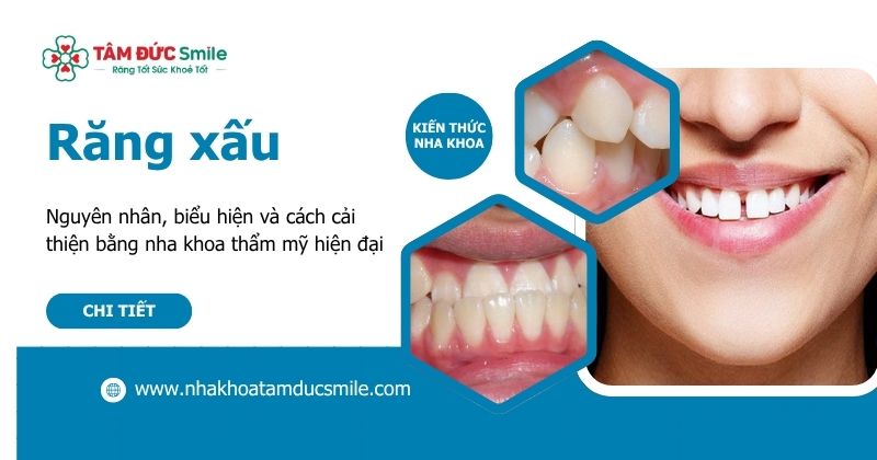răng xấu thường gây mất cân đối khuôn mặt, khiến nụ cười kém duyên, từ đó ảnh hưởng đến sự tự tin khi giao tiếp