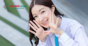 Niềng răng không còn bị gắn liền với khái niệm “phải điều trị”, mà đã được giới trẻ Thái Lan biến thành một xu hướng làm đẹp độc đáo