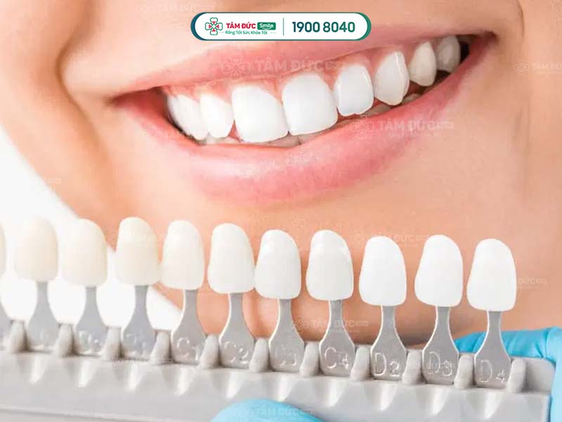 Tẩy trắng răng tại nha khoa giúp tiết kiệm thời gian và công sức