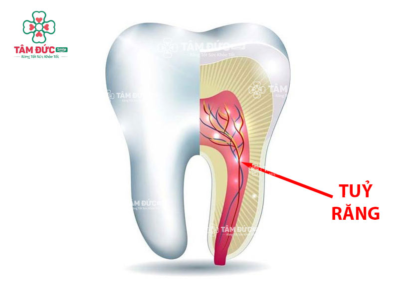 Tủy răng là phần mô mềm nằm sâu bên trong trung tâm răng