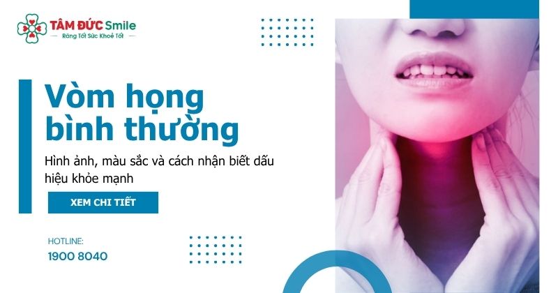 Vòm họng bình thường