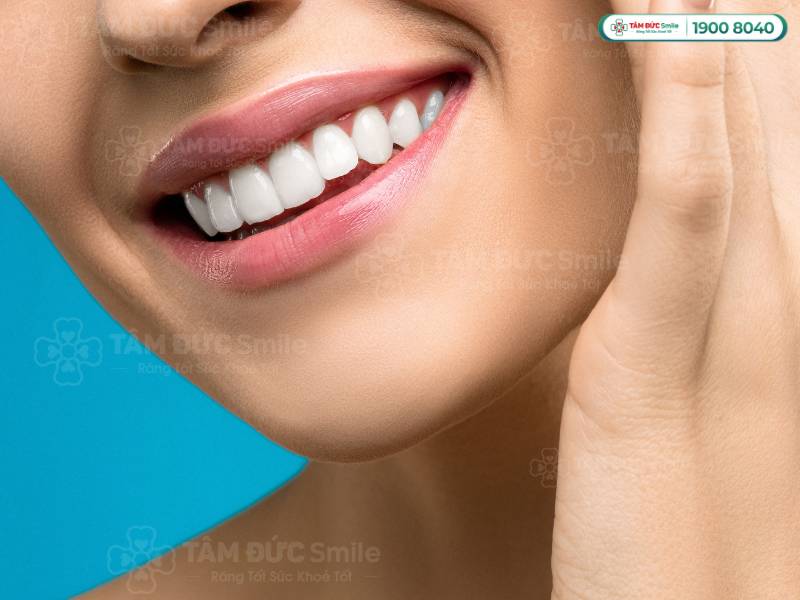 Nụ cười hở 10 cái răng hay còn được gọi là "kiểu cười hoa hậu"