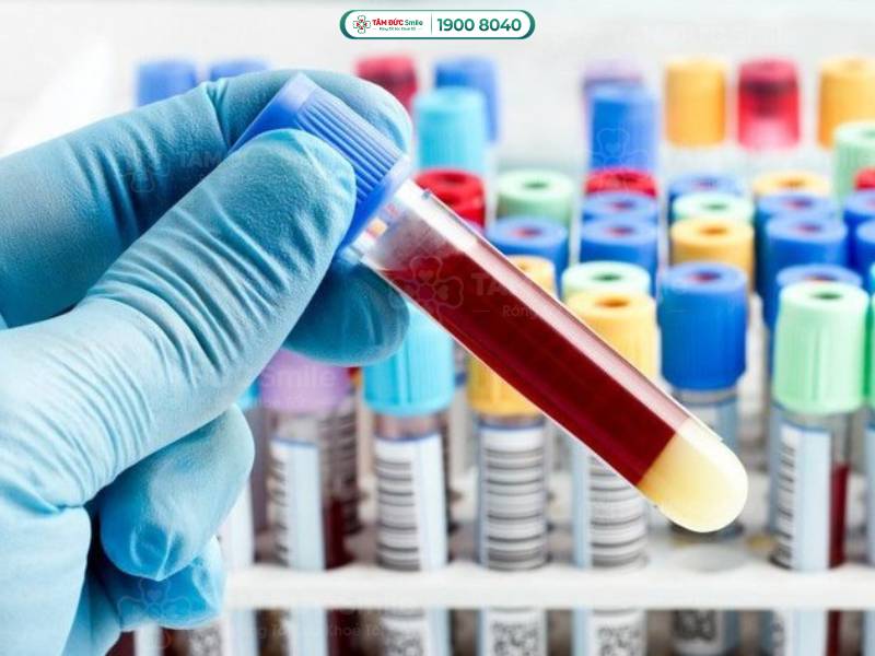 Xét nghiệm đông máu giúp bác sĩ xác định hướng điều trị cho bệnh nhân