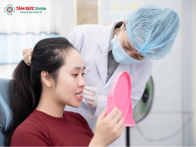 20 tuổi niềng răng bao nhiêu tiền? Bảng giá & ưu đãi niềng răng Invisalign, mắc cài