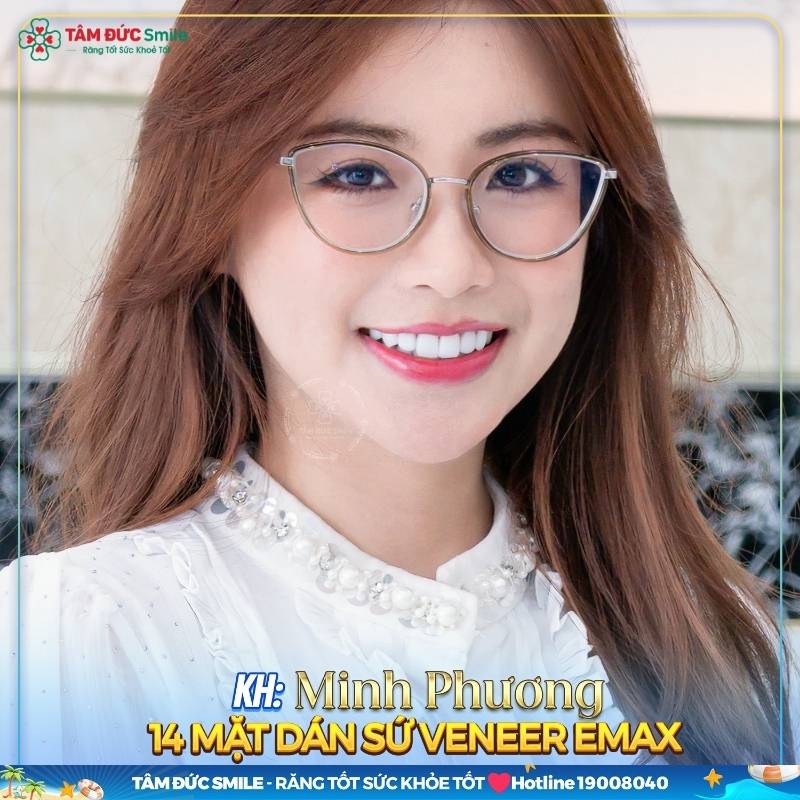 Dịch vụ thẩm mỹ răng sứ tại quận 1 hiện đang trở nên thịnh hành