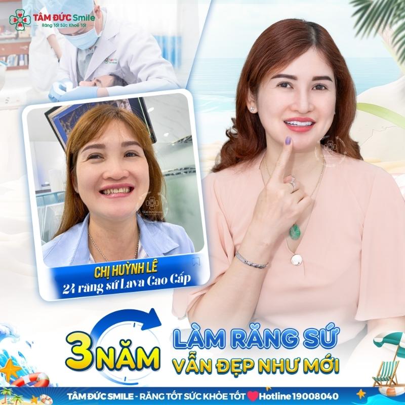 Hình ảnh thực tế của khách hàng trước và sau khi bọc răng sứ tại Nha khoa Tâm Đức Smile