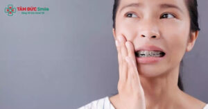 Niềng răng bị sưng nướu thường xuất hiện trong giai đoạn đầu chỉnh nha