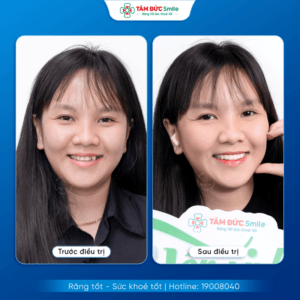 nieng-rang-ca-mau-1