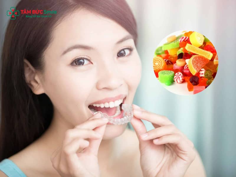 Niềng răng nên kiêng gì? Thực phẩm cần tránh để bảo vệ mắc cài hiệu quả