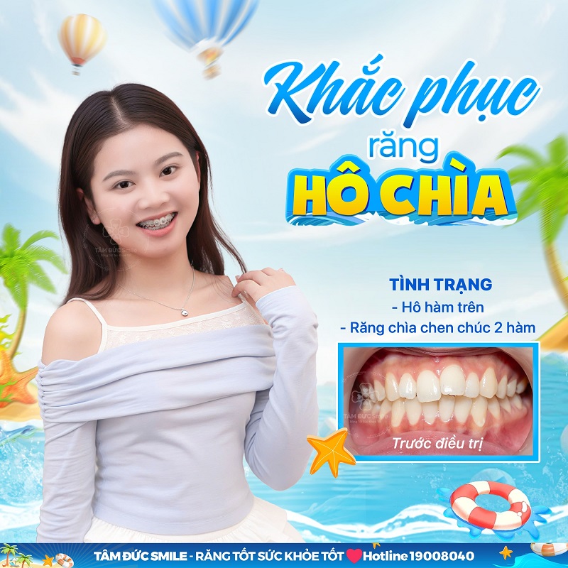 nieng-rang-tan-phu-2