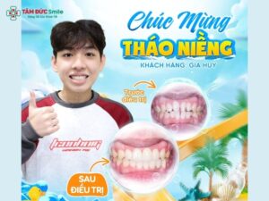Hàm răng đều đẹp giúp cải thiện thẩm mỹ, chức năng ăn nhai và sự tự tin