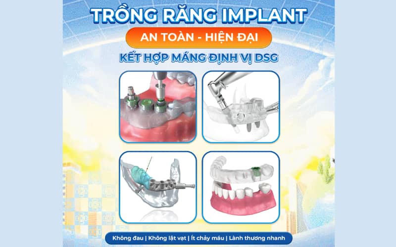 Dịch vụ Implant và răng sứ chất lượng cao tại Nha khoa Tâm Đức Smile, chi nhánh Tân Bình