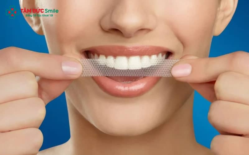 Sử dụng miếng dán trắng răng quá lâu có thể gây hại cho nướu, dẫn đến kích ứng hoặc bỏng