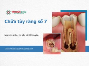 chua-tuy-rang-so-7-5