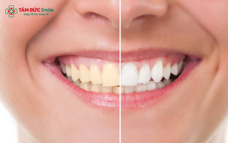 Chế độ ăn khoa học hỗ trợ hiệu quả cho việc bảo vệ và duy trì hàm răng trắng sáng