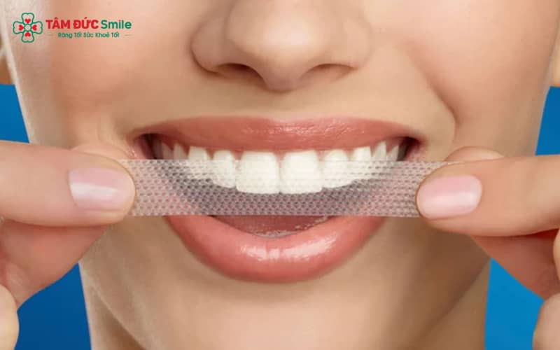 Khám răng miệng định kỳ tại nha khoa là bước cần thiết trước khi áp dụng miếng dán trắng răng
