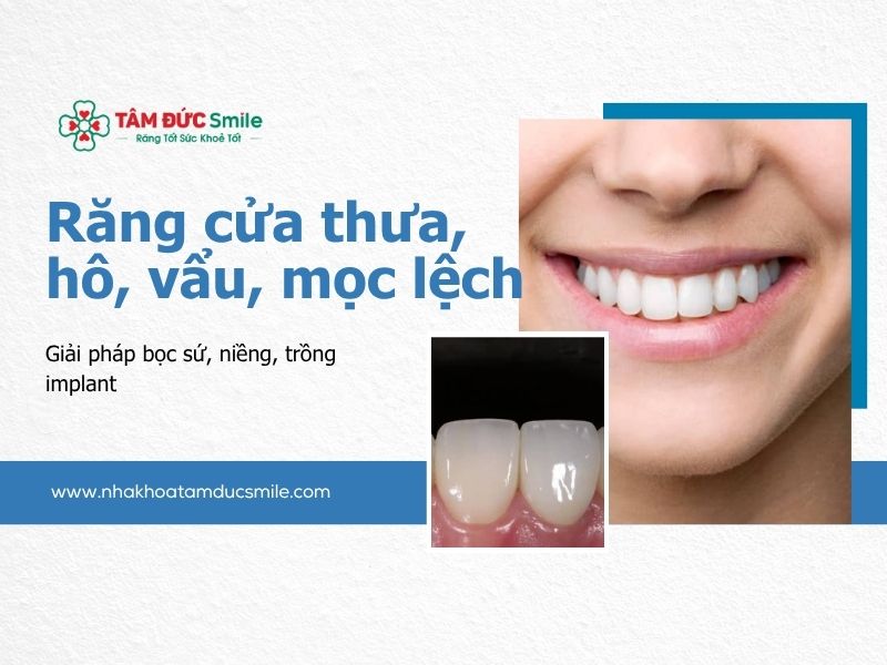 rang-cua