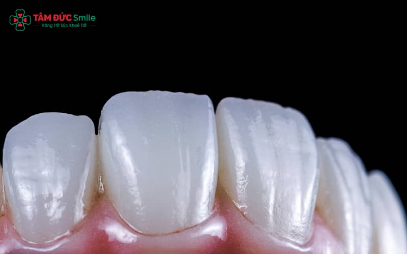 Răng sứ Lava 3M được hình thành từ Ceramic Nano cao cấp và gia công qua nhiệt độ nung cao