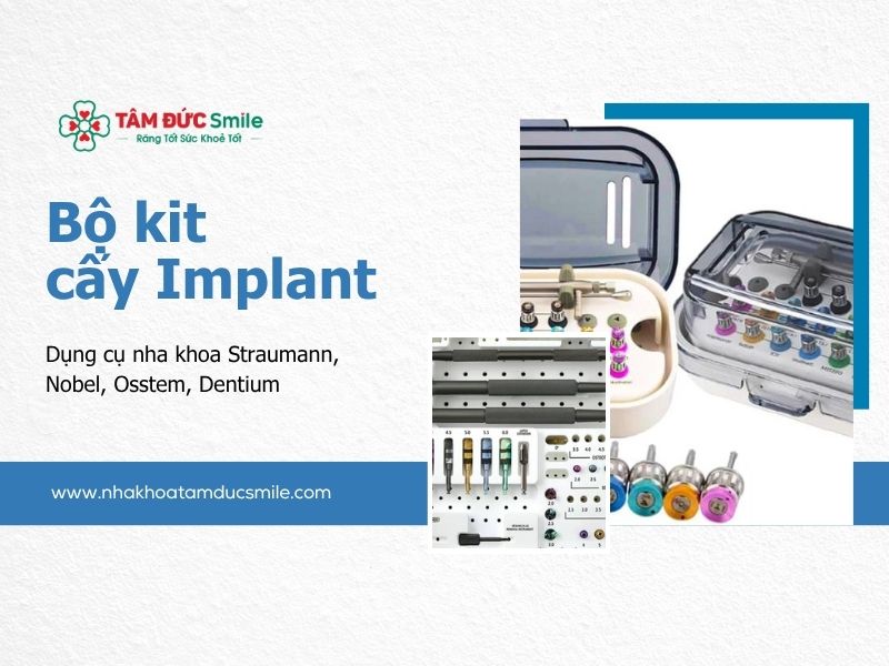 bo-kit-cay-implant