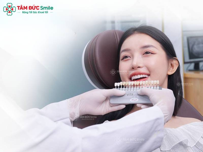 Tuổi thọ răng sứ phụ thuộc vào vật liệu, kỹ thuật phục hình và chế độ chăm sóc – Nha khoa Tâm Đức Smile.