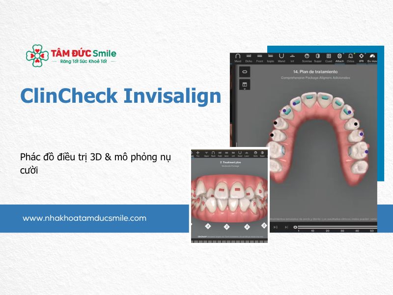 clincheck-invisalign-5