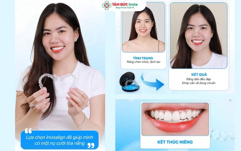 Niềng răng Invisalign có chính sách trả góp tại nhiều cơ sở nha khoa, giúp bạn dễ dàng quản lý chi phí điều trị