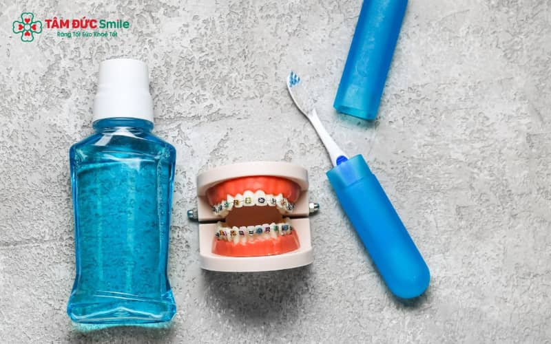 Sản phẩm nước súc miệng dành cho người niềng hỗ trợ làm sạch sâu, ngăn ngừa mảng bám tích tụ ở các khe mắc cài