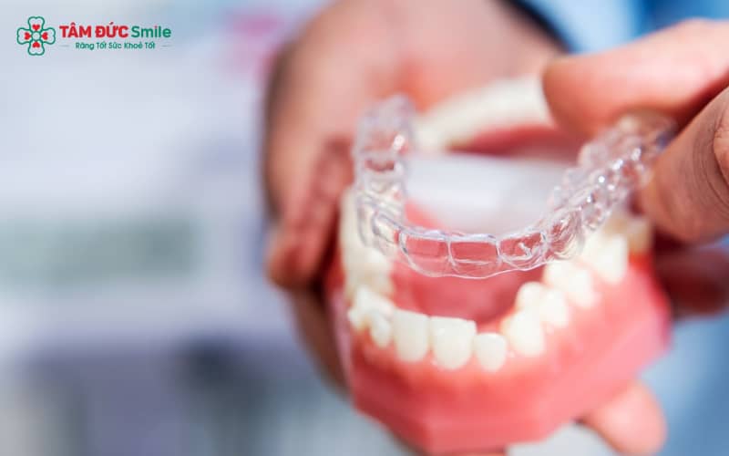 Mức giá trọn gói niềng răng Invisalign thường nằm trong khoảng 40 – 120 triệu VNĐ