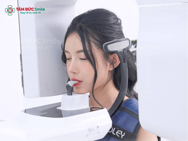 rang-boc-su-bi-viem-tuy-3