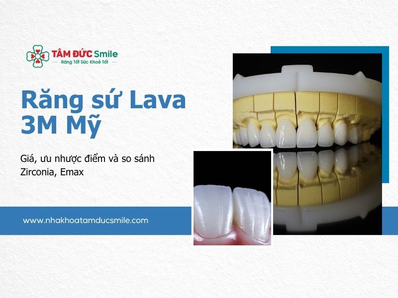 rang-su-lava-3m